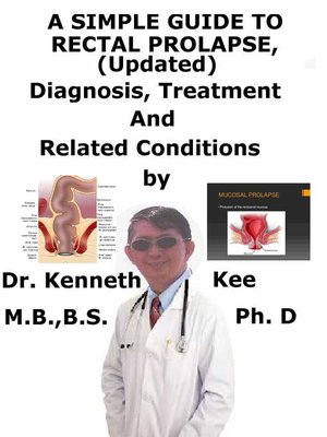 cover image of A Simple Guide to Rectal Prolapse, (Updated) diagnosis, Treatment and Related Conditions